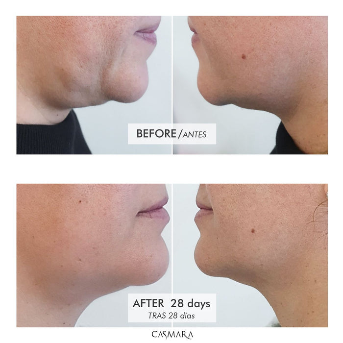 Crème Restructurante Tense-Lift 100ml - Casmara - 3