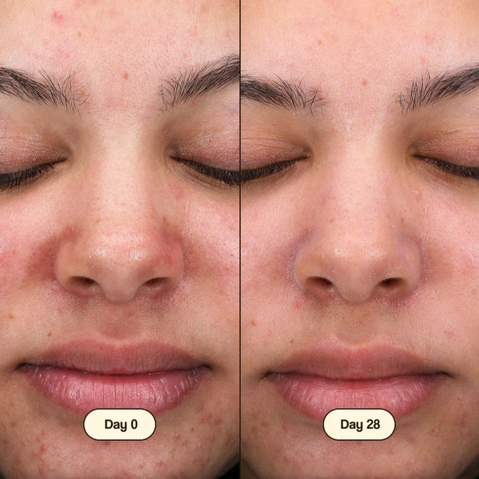 Nettoyant Visage à l'Acide Salicylique 100ml - Freshly Cosmetics - 2