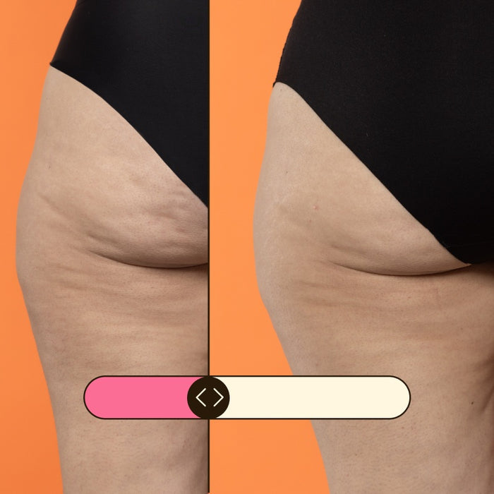 Crème anticellulite et réductrice Beta-Burner Sculpting 100ml - Freshly Cosmetics - 3